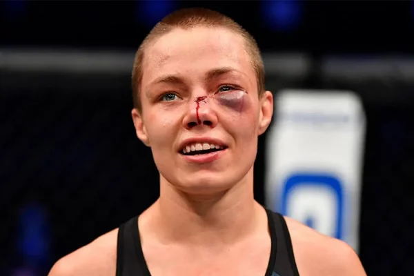 Rose Namajunas darf nach Augenoperation das Training wieder aufnehmen.